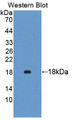 Western Blot; Sample: Recombinant protein.