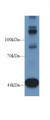 Western Blot; Sample: Mouse Heart lysate; Primary Ab: 1µg/ml Rabbit Anti-Human TNS1 Antibody Second Ab: 0.2µg/mL HRP-Linked Caprine Anti-Rabbit IgG Polyclonal Antibody