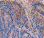 Used in DAB staining on fromalin fixed paraffin- embedded Kidney tissue