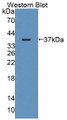 Western Blot; Sample: Recombinant protein.