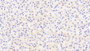 DAB staining on IHC-P; Samples: Human Liver Tissue;  Primary Ab: 20μg/ml Rabbit Anti-Human THRSP Antibody Second Ab: 2µg/mL HRP-Linked Caprine Anti-Rabbit IgG Polyclonal Antibody 