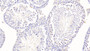 DAB staining on IHC-P; Samples: Mouse Testis Tissue;  Primary Ab: 20μg/ml Rabbit Anti-Mouse TESK1 Antibody Second Ab: 2µg/mL HRP-Linked Caprine Anti-Rabbit IgG Polyclonal Antibody 
