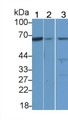 Western Blot; Sample: Lane1: Rat Liver lysate; Lane2: Mouse Liver lysate; Lane3: Mouse Kidney lysate; Primary Ab: 4μg/ml Rabbit Anti-Human TESK1 Antibody; Second Ab: 0.2µg/mL HRP-Linked Caprine Anti-Rabbit IgG Polyclonal Antibody;