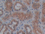 DAB staining on IHC-P; Samples: Human Kidney Tissue;  Primary Ab: 10µg/ml Rabbit Anti-Human RL Antib