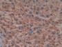 DAB staining on IHC-P; Samples: Human Liver Tissue; Primary Ab: 10µg/ml Rabbit Anti-Human RL Antibody Second Ab: 2µg/mL HRP-Linked Caprine Anti-Rabbit IgG Polyclonal Antibody