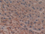 DAB staining on fromalin fixed paraffin- embedded liver tissue)