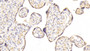 DAB staining on IHC-P; Samples: Human Placenta Tissue; Primary Ab: 20μg/ml Rabbit Anti-Human RPN1 Antibody Second Ab: 2µg/mL HRP-Linked Caprine Anti-Rabbit IgG Polyclonal Antibody