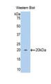 Western Blot; Sample: Recombinant protein.