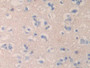 DAB staining on fromalin fixed paraffin- embedded liver tissue)