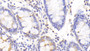 DAB staining on IHC-P; Samples: Human Colon Tissue; Primary Ab: 20μg/ml Rabbit Anti-Human PRODH Antibody Second Ab: 2µg/mL HRP-Linked Caprine Anti-Rabbit IgG Polyclonal Antibody