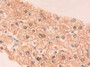 DAB staining on IHC-P; Samples: Human Liver Tissue; Primary Ab: 20µg/ml Rabbit Anti-Human PAH Antibody Second Ab: 2µg/mL HRP-Linked Caprine Anti-Rabbit IgG Polyclonal Antibody