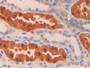 DAB staining on IHC-P;  Samples: Human Kidney Tissue