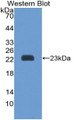 Western Blot; Sample: Recombinant protein.