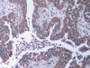 DAB staining on IHC-P. Samples: Human Tissue)