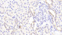 DAB staining on IHC-P; Samples: Human Kidney Tissue;  Primary Ab: 20μg/ml Rabbit Anti-Human PUS1 Antibody Second Ab: 2µg/mL HRP-Linked Caprine Anti-Rabbit IgG Polyclonal Antibody 