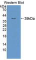 Western Blot; Sample: Recombinant protein.