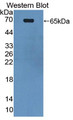 Western Blot; Sample: Recombinant protein.