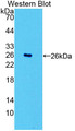 Western Blot; Sample: Recombinant protein.