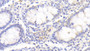 DAB staining on IHC-P; Samples: Human Colon Tissue; Primary Ab: 20μg/ml Rabbit Anti-Human PNPO Antibody Second Ab: 2µg/mL HRP-Linked Caprine Anti-Rabbit IgG Polyclonal Antibody