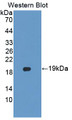 Western Blot; Sample: Recombinant protein.