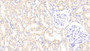 DAB staining on IHC-P; Samples: Rat Kidney Tissue; Primary Ab: 20μg/ml Rabbit Anti-Rat PLTP Antibody Second Ab: 2µg/mL HRP-Linked Caprine Anti-Rabbit IgG Polyclonal Antibody