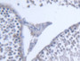 DAB staining on fromalin fixed paraffin- embedded kidney tissue)