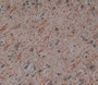 Used in DAB staining on fromalin fixed paraffin- embedded Kidney tissue