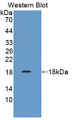 Western Blot; Sample: Recombinant protein.