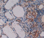 Prefoldin Subunit 1 (Pfdn1) Polyclonal Antibody, Cat#CAU23934