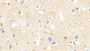 DAB staining on fromalin fixed paraffin- embedded Kidney tissue)