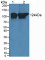 Western Blot; Sample: Lane1: Human Jurkat cells; Lane2: Human Hela cells.