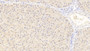 DAB staining on IHC-P; Samples: Human Liver Tissue; Primary Ab: 20μg/ml Rabbit Anti-Human PCNT Antibody Second Ab: 2µg/mL HRP-Linked Caprine Anti-Rabbit IgG Polyclonal Antibody