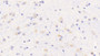 DAB staining on IHC-P; Samples: Mouse Cerebrum Tissue;  Primary Ab: 20μg/ml Rabbit Anti-Mouse OPHN1 Antibody Second Ab: 2µg/mL HRP-Linked Caprine Anti-Rabbit IgG Polyclonal Antibody 