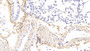 DAB staining on IHC-P; Samples: Mouse Lung Tissue; Primary Ab: 20μg/ml Rabbit Anti-Mouse OGN Antibody Second Ab: 2µg/mL HRP-Linked Caprine Anti-Rabbit IgG Polyclonal Antibody