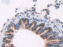 DAB staining on IHC-P; Samples: Rat Lung Tissue; Primary Ab: 10µg/ml Rabbit Anti-Rat OAS1 Antibody Second Ab: 2µg/mL HRP-Linked Caprine Anti-Rabbit IgG Polyclonal Antibody