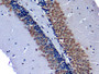 DAB staining on IHC-P; Samples: Mouse Cerebrum Tissue)