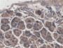 DAB staining on fromalin fixed paraffin- embedded spleen tissue)