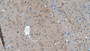 DAB staining on IHC-P; Samples: Rat Cerebrum Tissue;  Primary Ab: 10µg/ml Rabbit Anti-Rat NCDN Antibody Second Ab: 2µg/mL HRP-Linked Caprine Anti-Rabbit IgG Polyclonal Antibody 