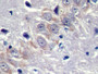 DAB staining on IHC-P; Samples: Rat Cerebrum Tissue