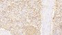 DAB staining on IHC-P; Samples: Human Spleen Tissue;  Primary Ab: 20μg/ml Rabbit Anti-Human MSN Antibody Second Ab: 2µg/mL HRP-Linked Caprine Anti-Rabbit IgG Polyclonal Antibody 