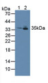 Western Blot; Sample: Lane1: Rat Brain Tissue; Lane2: Rat Heart Tissue.