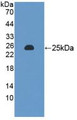 Western Blot; Sample: Recombinant MTX1, Rat.