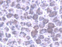 DAB staining on IHC-P; Samples: Mouse Stomach Tissue;  Primary Ab: 20µg/ml Rabbit Anti-Mouse MTX1 An