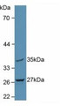 Western Blot; Sample: Rat Brain Tissue.