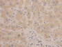 DAB staining on IHC-P; Samples: Human Liver Tissue; Primary Ab: 20µg/ml Rabbit Anti-Human MSMb Antibody Second Ab: 2µg/mL HRP-Linked Caprine Anti-Rabbit IgG Polyclonal Antibody