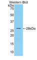 Western Blot; Sample: Recombinant protein.