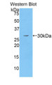 Western Blot; Sample: Recombinant protein.