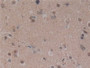 DAB staining on IHC-P; Samples: Human Brain Tissue; Primary Ab: 10µg/ml Rabbit Anti-Human MFAP2 Antibody Second Ab: 2µg/mL HRP-Linked Caprine Anti-Rabbit IgG Polyclonal Antibody