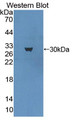 Western Blot; Sample: Recombinant protein.