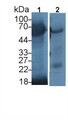 Western Blot; Sample: Lane1: Human Lung lysate; Lane2: Porcine Lung lysate&lt;br/&gt;Primary Ab: 1µg/ml Rabbit Anti-Human MECP2 Antibody&lt;br/&gt;Second Ab: 0.2µg/mL HRP-Linked Caprine Anti-Rabbit IgG Polyclonal Antibody&lt;br/&gt;